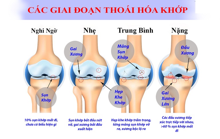 Sưng tấy ngón chân là bị gì?